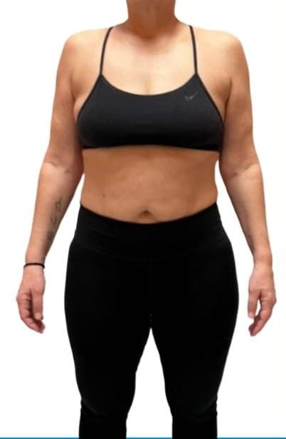 Client after, front view