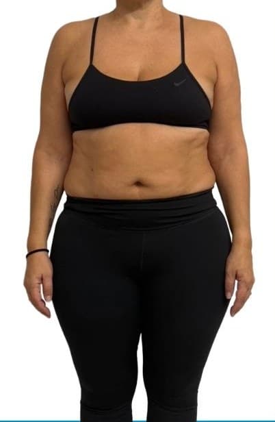 Client before, front view
